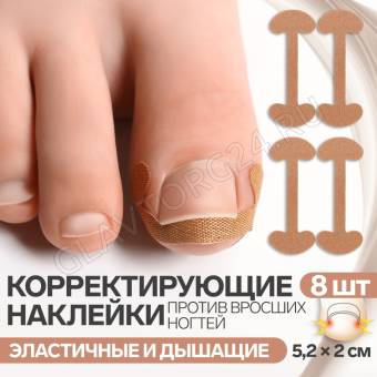 Наклейки против вросших ногтей 8шт (5,2*2см) 12*6см беж к/кор QF   9438983